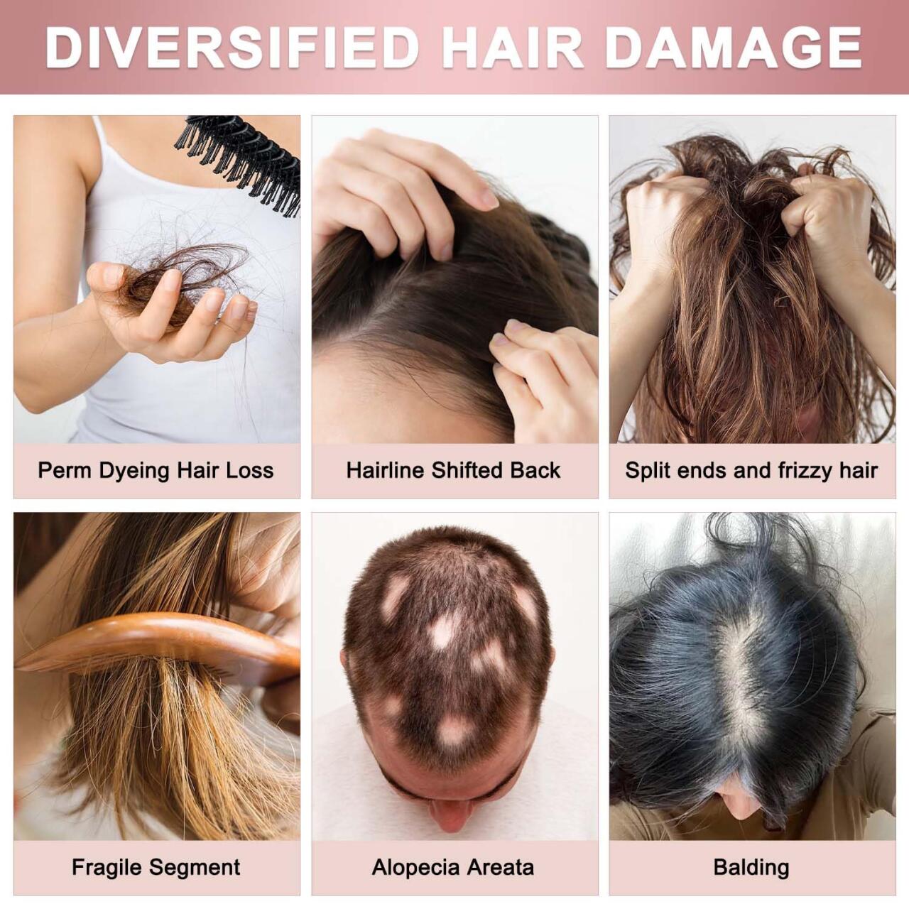 SPRAYS PARA FAVORECER EL CRECIMIENTO DEL CABELLO