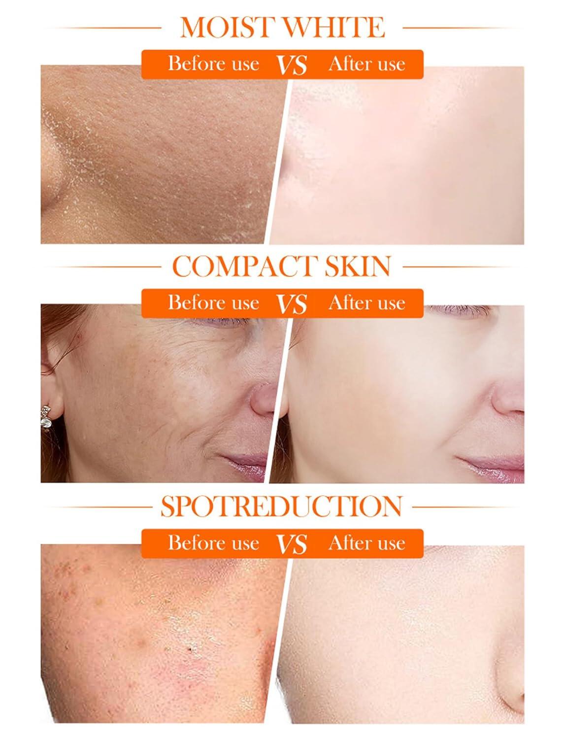 CREMA FACIAL BLANQUEADORA ILUMINADORA 5 EN 1 CON VITAMINA C ACTIVA + NIACINAMIDA