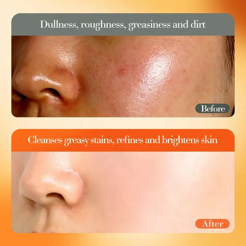 CREMA FACIAL BLANQUEADORA E ILUMINADORA CON VITAMINA C